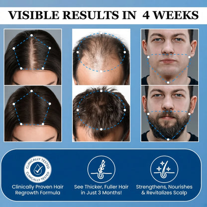 Neravy Hair Growth Roll on Serum